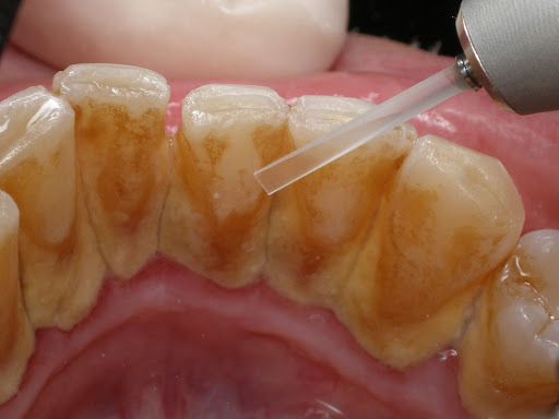 periodontoloji 1