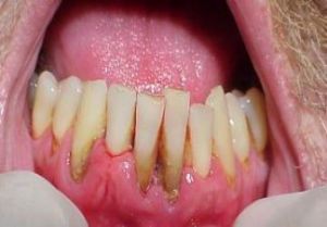 periodontoloji 2
